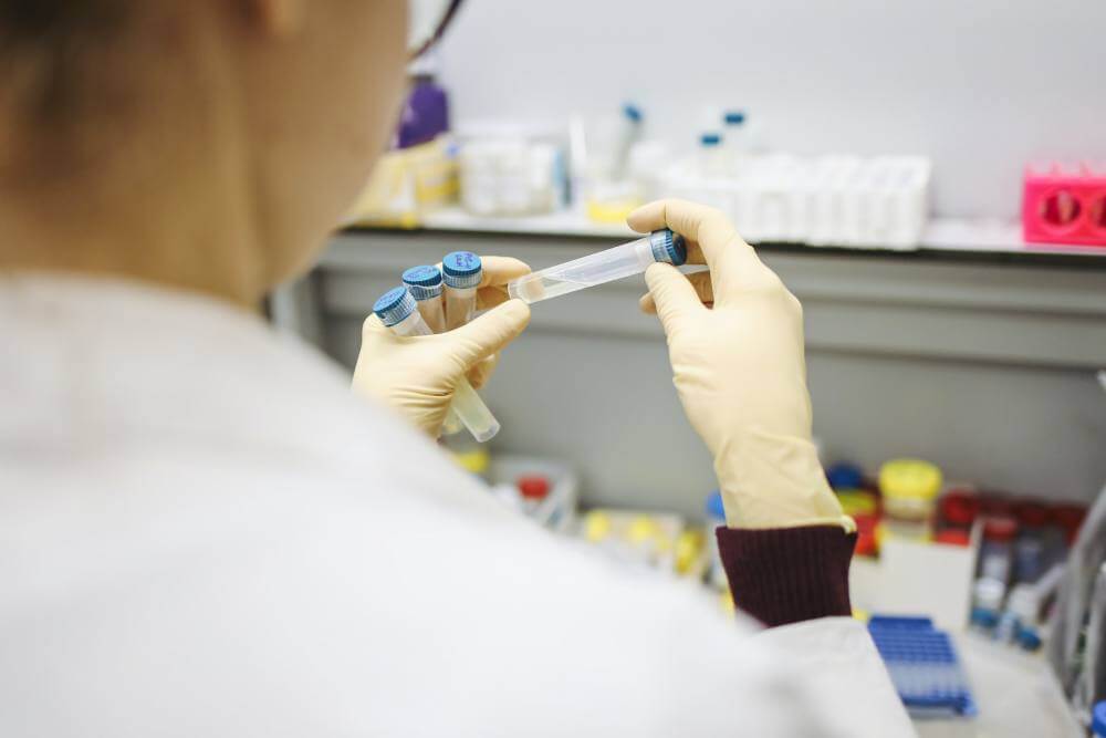 Saúde registra atraso no fornecimento de testes de Covid-19