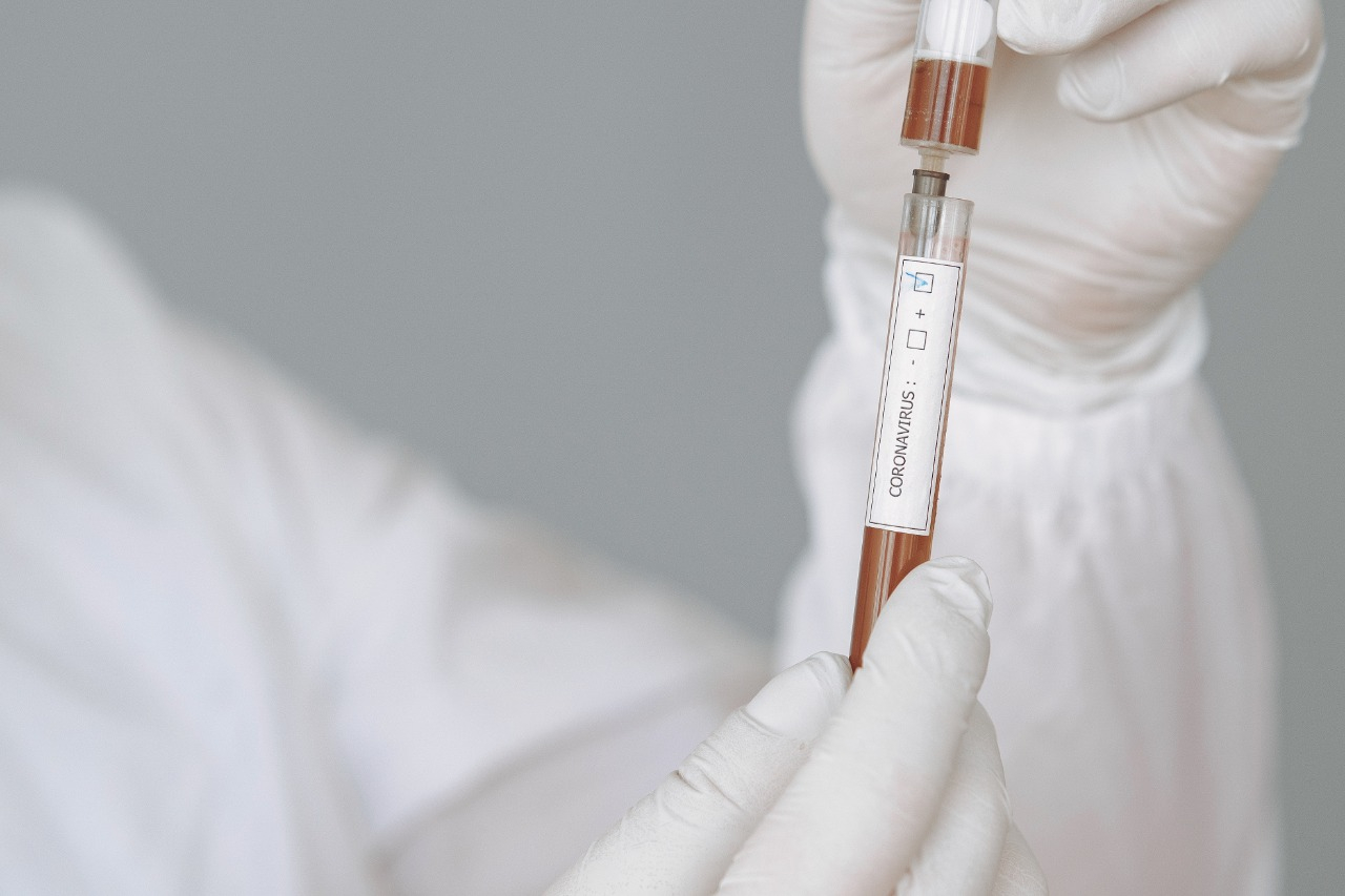 Saúde amplia testes da Covid-19